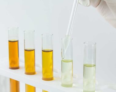 Analyse von verschiedenen Hydraulikölen